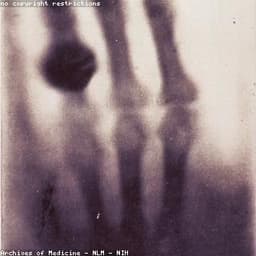 X-ray